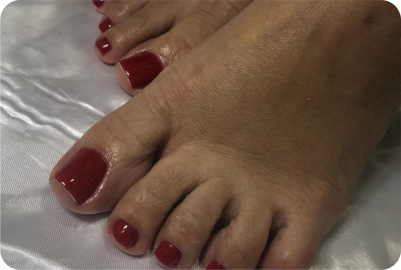 Esmaltação em gel pé
