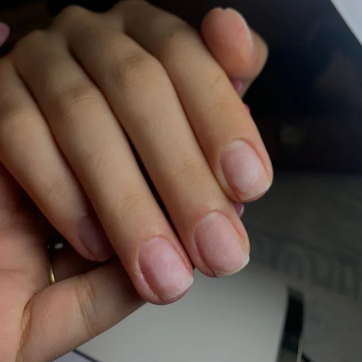 Remoção completa de gel